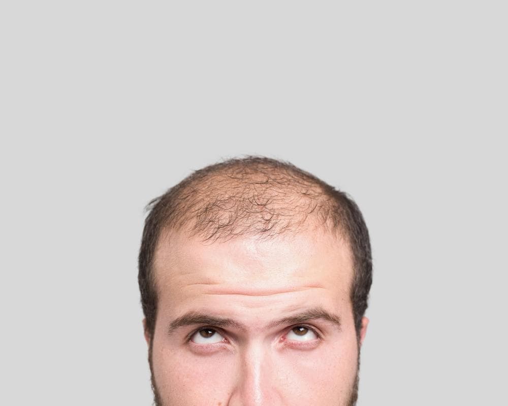 20 fascinating facts about hair: why baldness is super-masculine – and a pubic bush could be a ‘cheating detector’